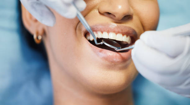 Best Chipped Tooth Repair Near Me  in Dupo, IL
